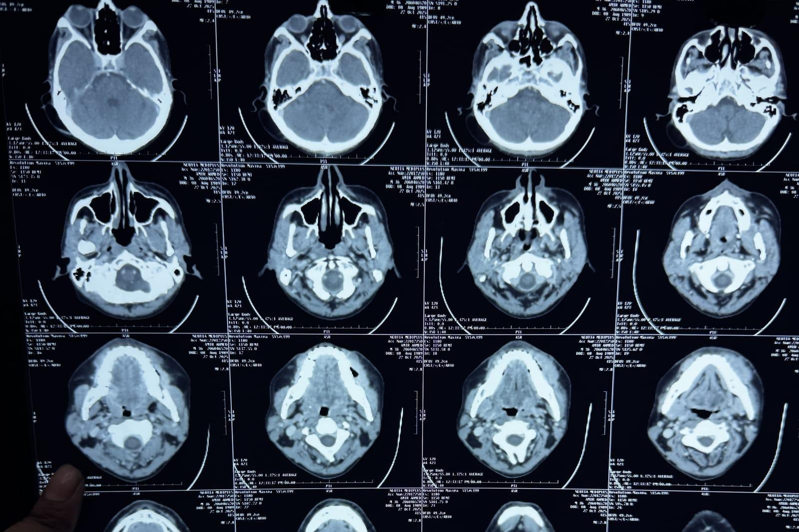 A viewing screen showing CT scan slices of a patient's head and neck